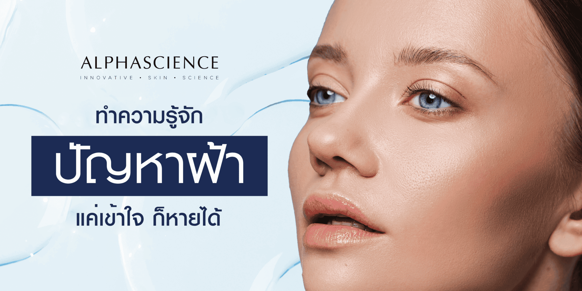 ฝ้า สาเหตุของฝ้า พฤติกรรมที่ทำให้ฝ้ารุนแรงขึ้น วิธีป้องกันฝ้า รักษาฝ้า